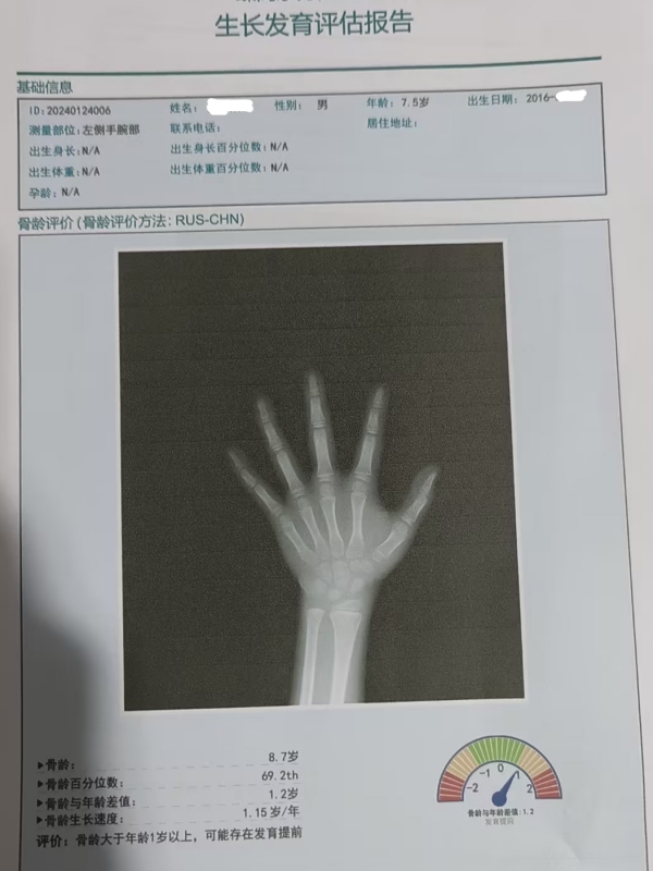 骨龄和身高有什么关系？每个孩子都有必要检测吗？